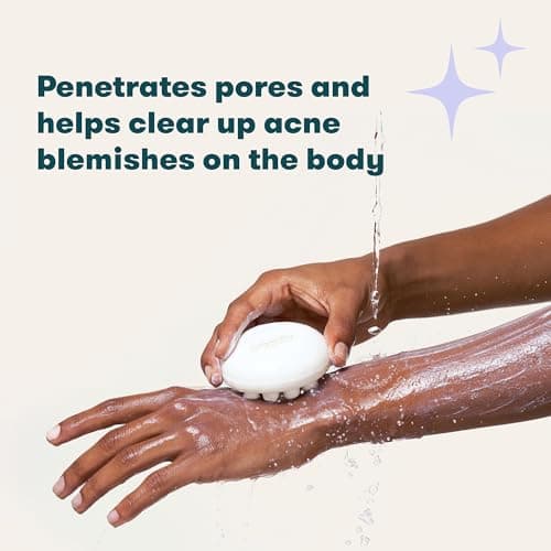 Proactiv Acne Body Bar- Salicylic Acid Cleanser And Acne Treatment, Face and Body Wash Acne Soap Bar- 4.5oz