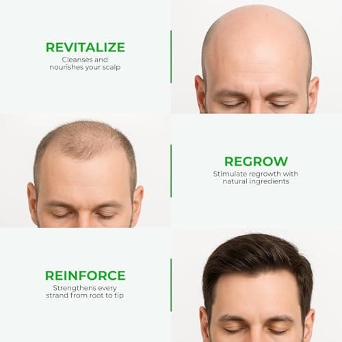 Green Wealth Neo Hair Lotion for Hair Loss Treatment | Hair Regrowth | Thinning, Bald Spots & Hair Fall | Trusted Formula with Ginseng, Saw Palmetto & Horsetail | 120ml / 4.06 fl oz