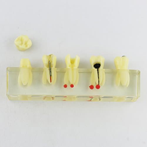 Dentalmall Dental Root Canal Endodontic Treatment Tooth Model for Teaching,Studying,Practice