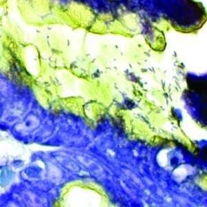 KT 019-100 - H. Pylori Rapid Stain Kit, Diagnostic Biosystems - Each