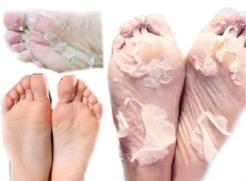 2pairs=4pcs Milk Bamboo Vinegar Remove Dead Skin Foot Skin Smooth Exfoliating Feet Mask Foot Care
