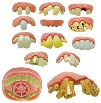Fun Fake Teeth - Set of 13 Rotten Dentures * Fun Fake Teeth
