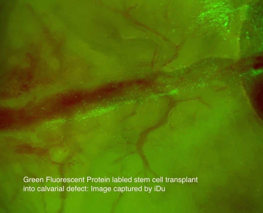 LabCam Microscope Adapter for iPhone 7/8 Plus