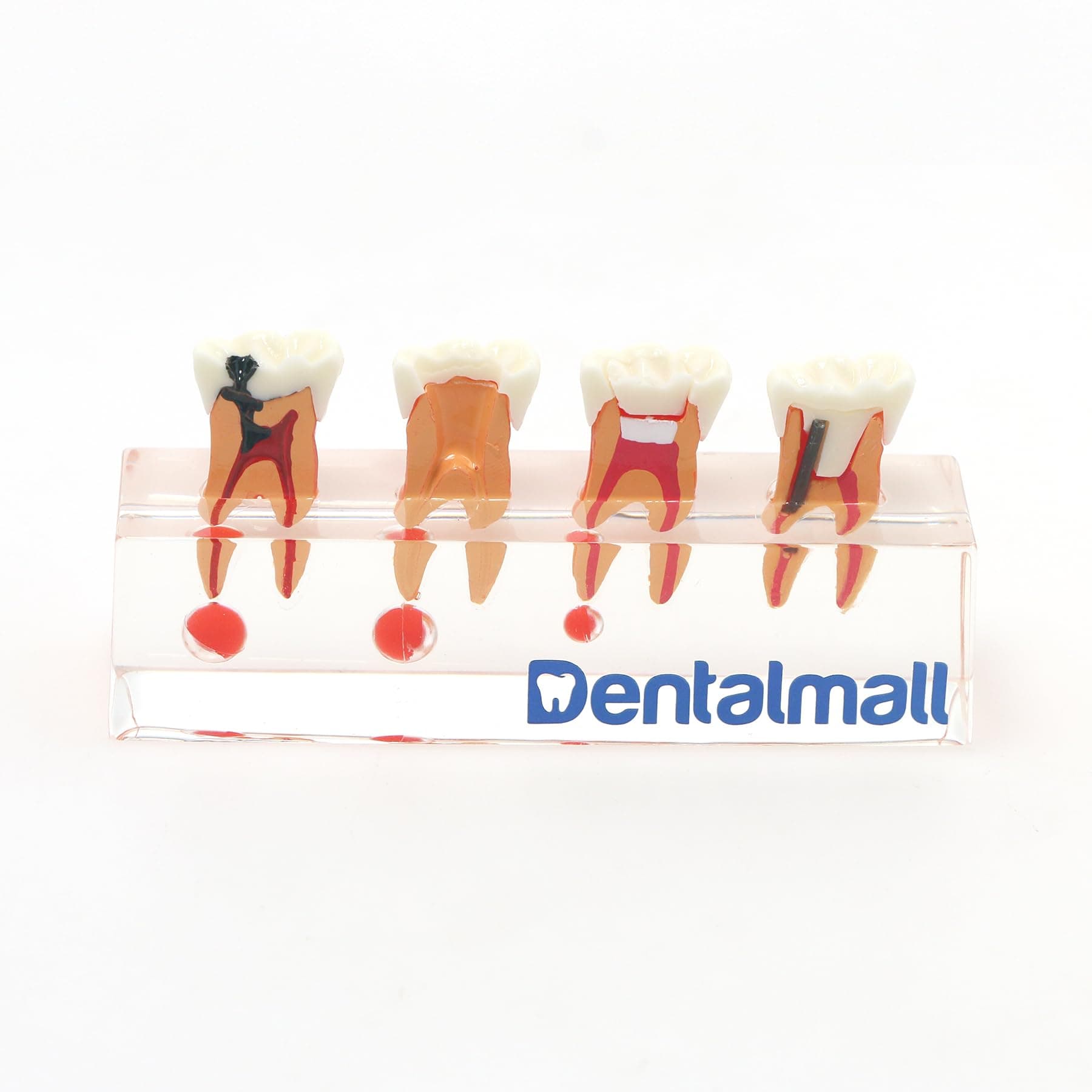 Dental 4-stage Endodontic Treatment Model for Study Teach Teeth Model 4018