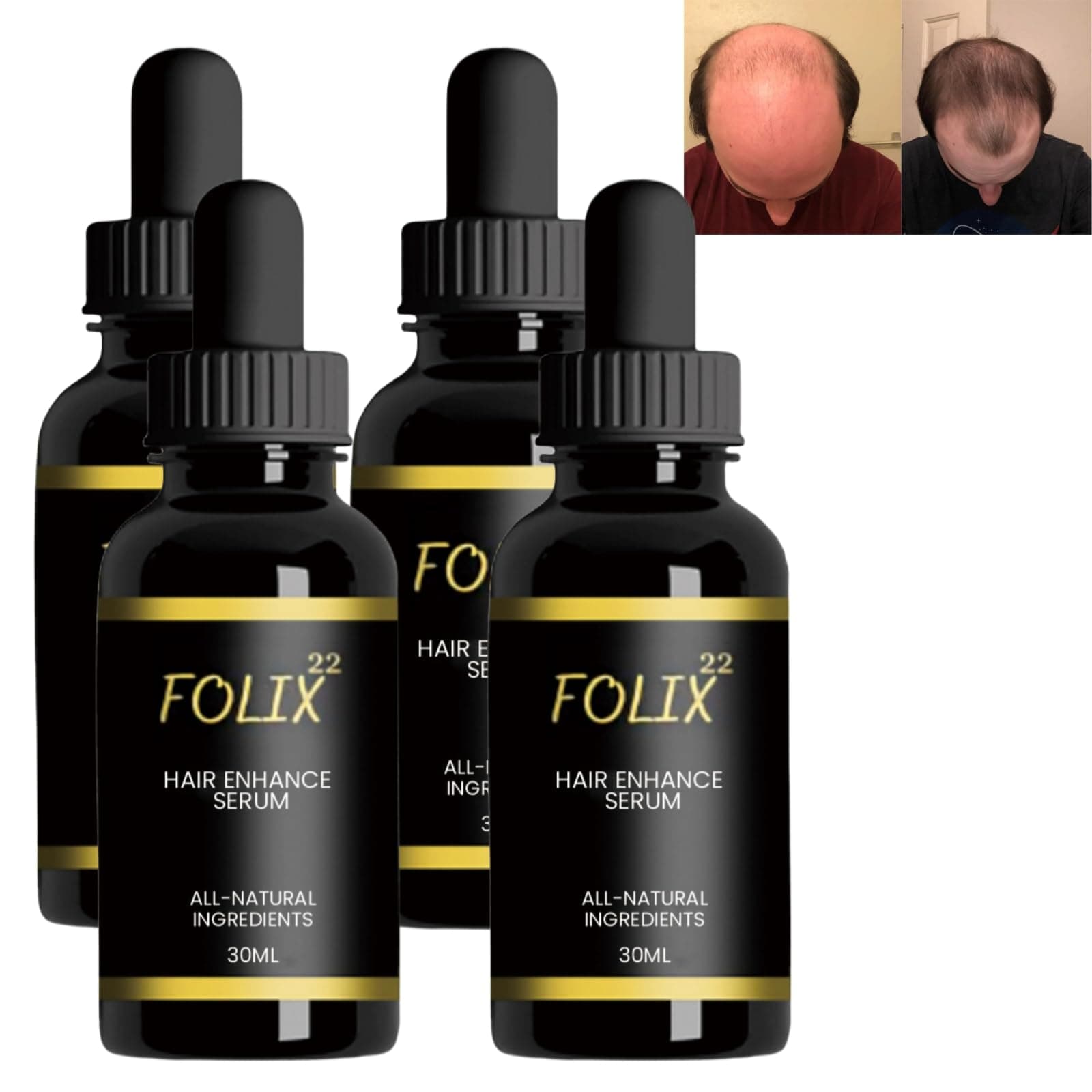 4Pack Folix22 Hair Growth Formula,Folix22 Hair Growth Serum,for Dry Damaged Hair and Hair Growth (4 PACK)