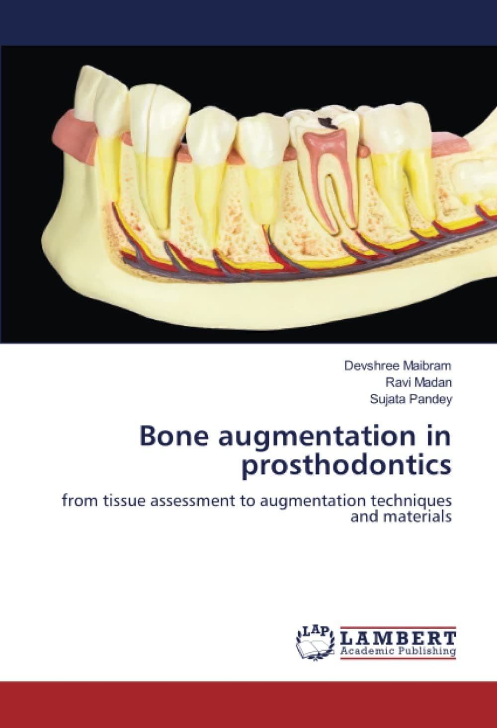 Bone augmentation in prosthodontics: from tissue assessment to augmentation techniques and materials