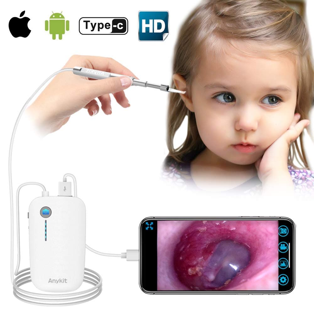 Otoscope iPhone, Anykit Upgraded 4.3mm 720P HD Ear Scope Camera Digital Otoscope with 6 LED Lights, Earwax Removal Tool and Specula for iPhone and Android Smartphone