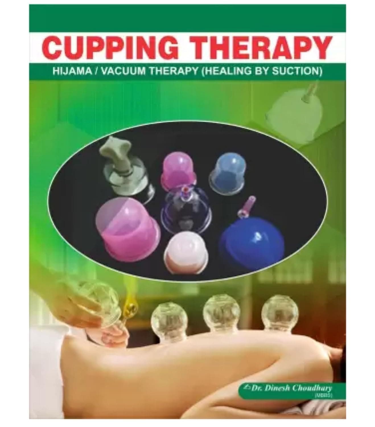 GM ACUPRESSURE(एक्यूप्रेशर) BOOKS IN ENGLISH, (Hijama Cupping Therapy-ENGLISH) Cupping (Hijama/Vacuum) Therapy Book - ENGLISH