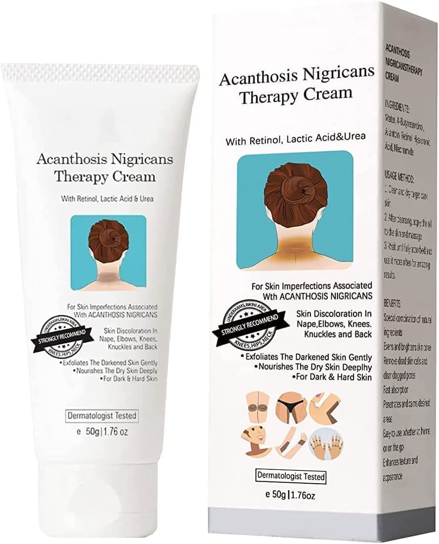 Nigrifree Acanthosis Nigricans Therapy Cream,Acanthosis Nigricans Treatment,Removal Of Hyperpigmentation,Dark Spot Corrector Cream, Dark Spot Remover for Neck,Ankles,Knuckles,Armpits,Thighs & Elbow