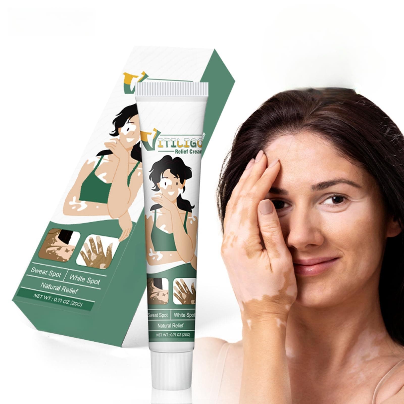 Vitiligo Relief Cream 20g - Effective Treatment for Vitiligo, Tinea Versicolor, & Hypopigmentation, Skin Care Ointment for Reducing White Patches, Herbal Formula for Skin Restoration