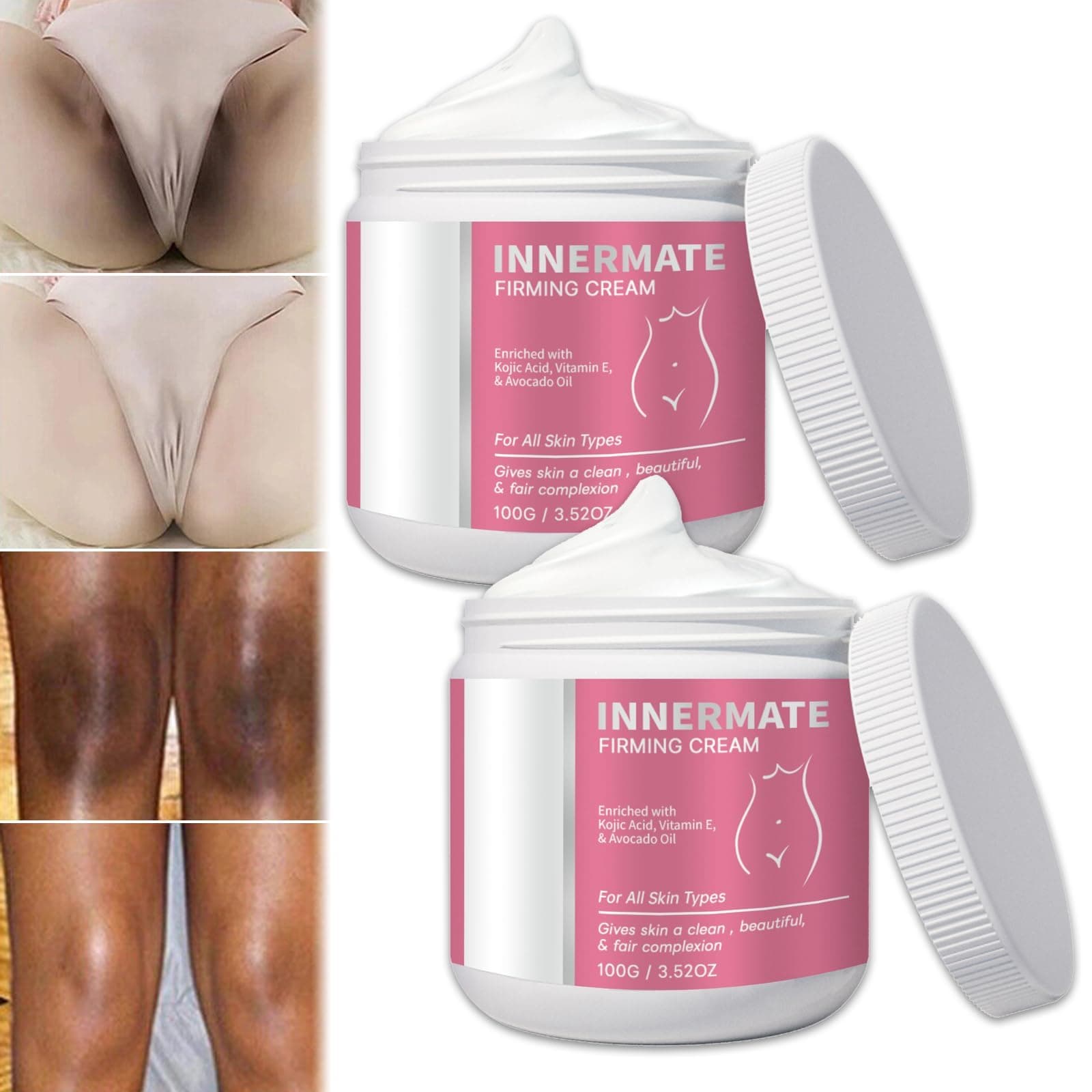 FAIRZ 2 Pcs Liascy Innermate Whitening Cream, Skin Bleaching Cream for Private Area, Dark Spot Corrector Cream, Intimate Skin Lightening Cream for Body, Bikini and Sensitive Areas