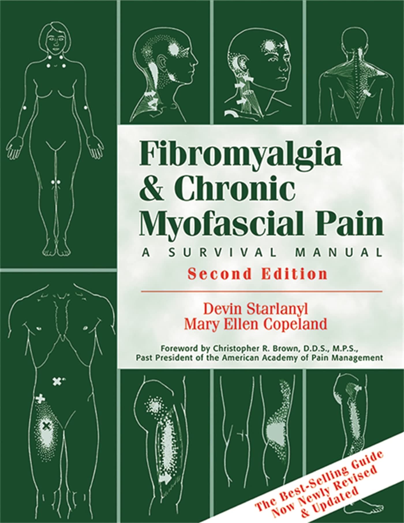 Fibromyalgia & Chronic Myofascial Pain: A Survival Manual Paperback – June 30, 2001