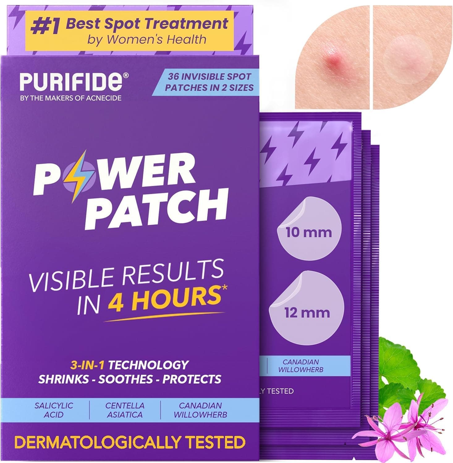 Purifide by Acnecide Power Pimple Patches, 36 Invisible Spot Patches with Salicylic Acid, Spot Treatment for All Skin Types  Superdrug Deep Action Extreme Targeted Solution Spot Treatment 15ml
