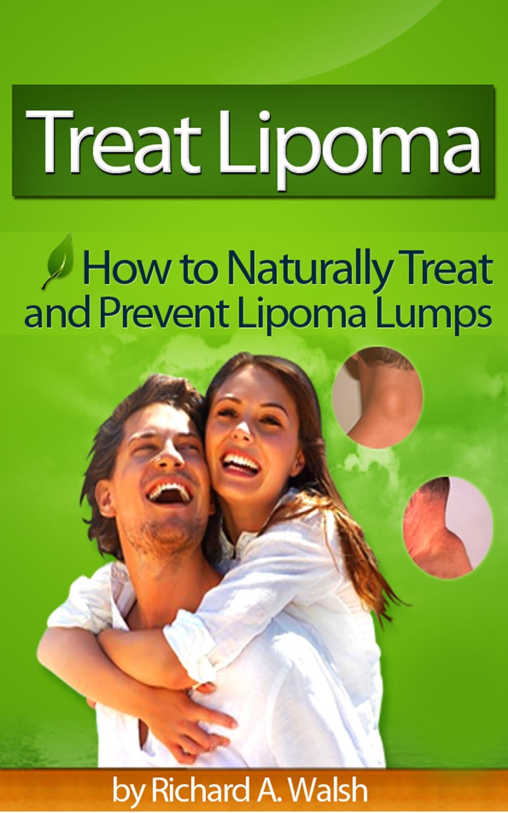 Treat Lipoma - How To Naturally Treat and Prevent Lipoma Lumps