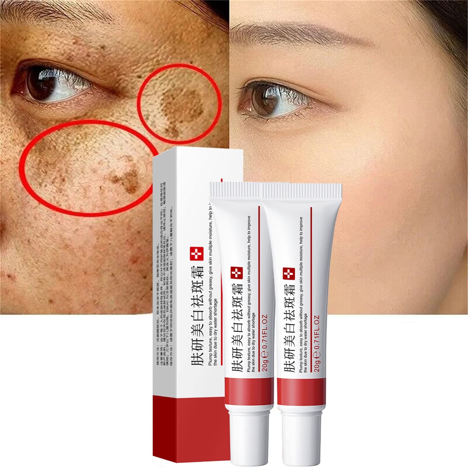 2 Pcs Freckle Cream, Acne Scar Removal Treatment Cream, Pigmentation Removal Cream for Face, Moisturizing Removes Facial Melasma Dark Spots Wrinkles Blemishes (freckle cream)