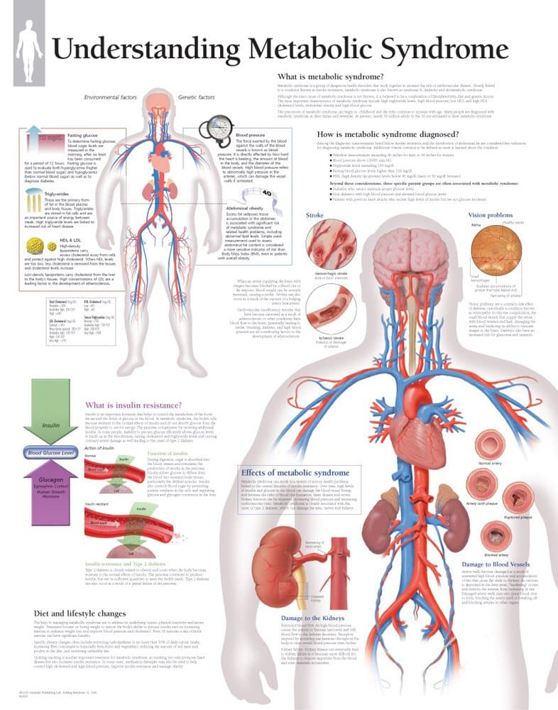 Metabolic Syndrome chart: Wall Chart