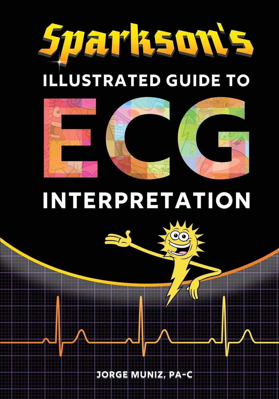 Sparkson's Illustrated Guide to ECG Interpretation Paperback – 1 Mar. 2018