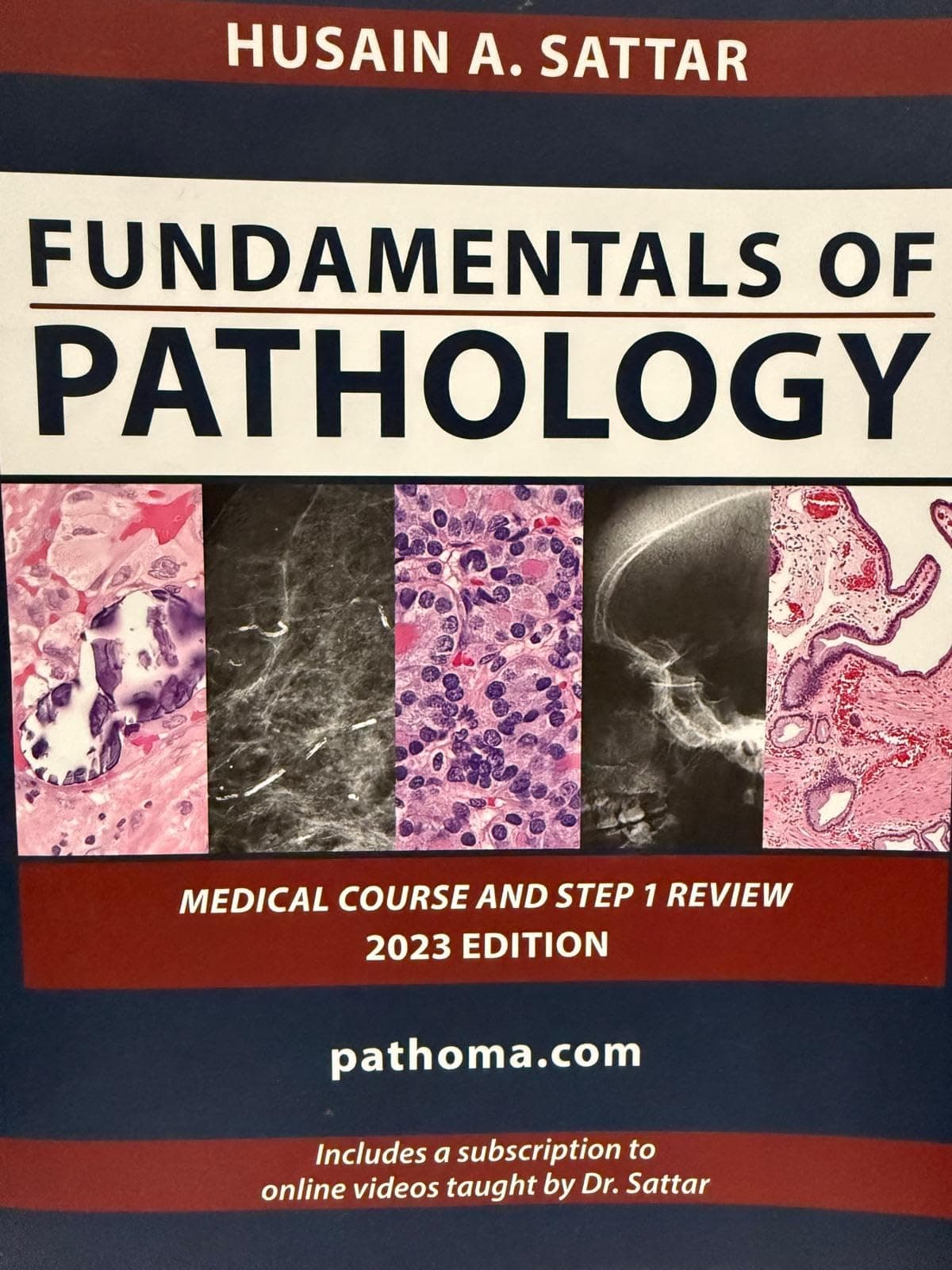 pathoma 2018Fundamentals of Pathology( paperback &videos) Paperback – January 1, 2018