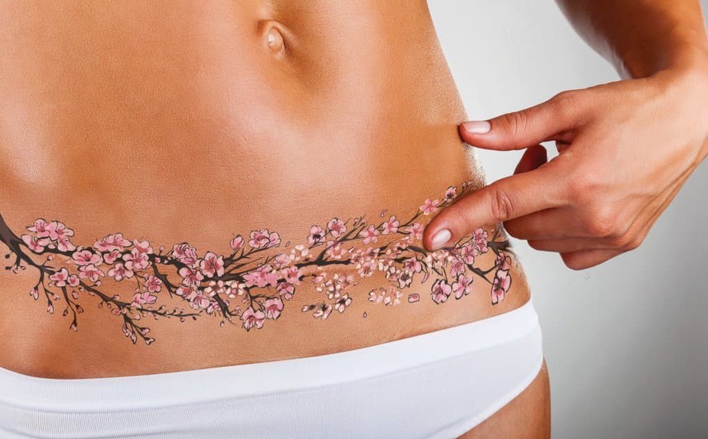 Sayura Cherry Blossom Temporary Tattoo - Tummy Tuck or Mastectomy Scar Cover, Realistic and Long Lasting, Fashionable and Safe