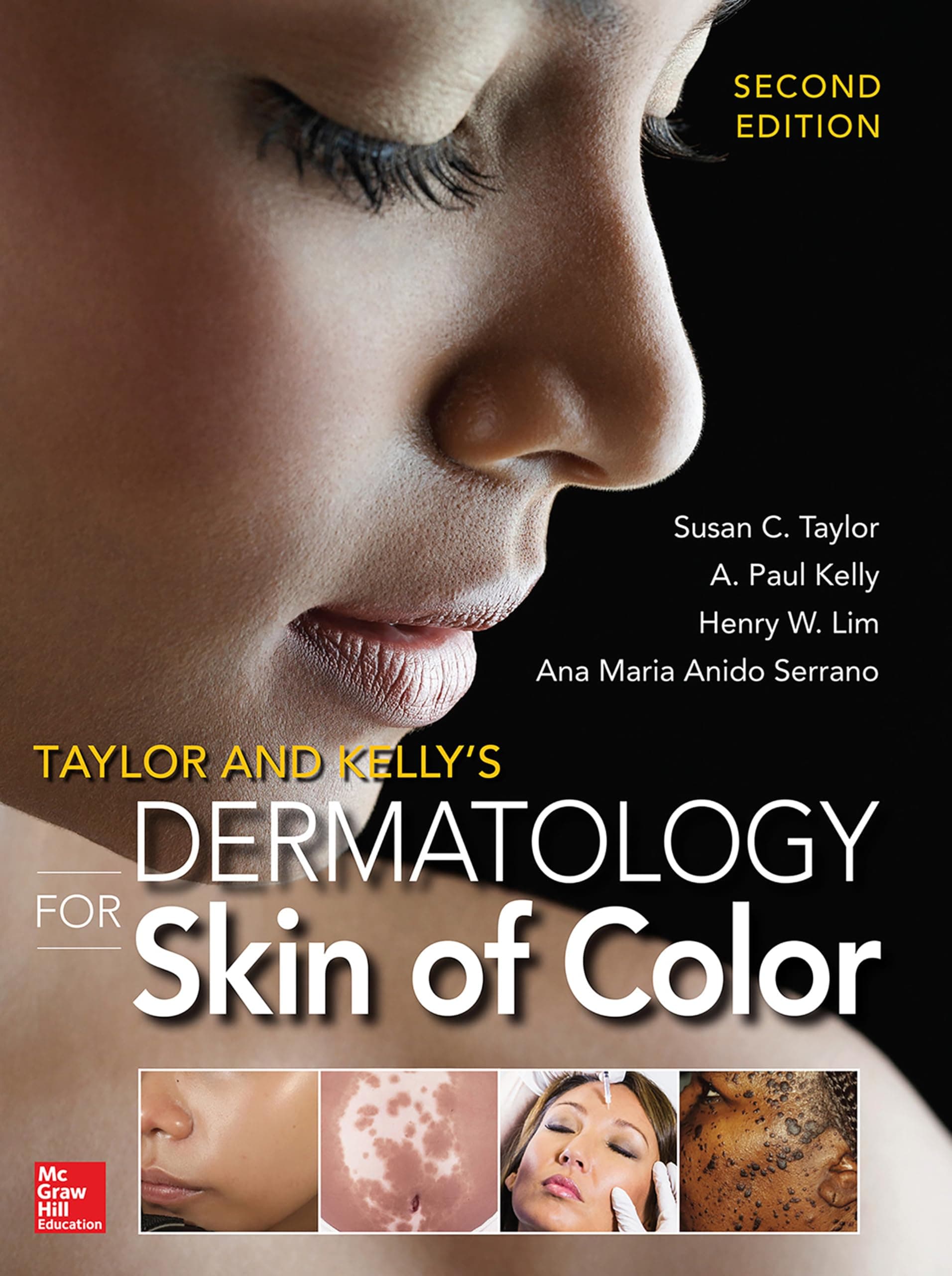 Taylor and Kelly's Dermatology for Skin of Color Hardcover – Illustrated, March 4, 2016