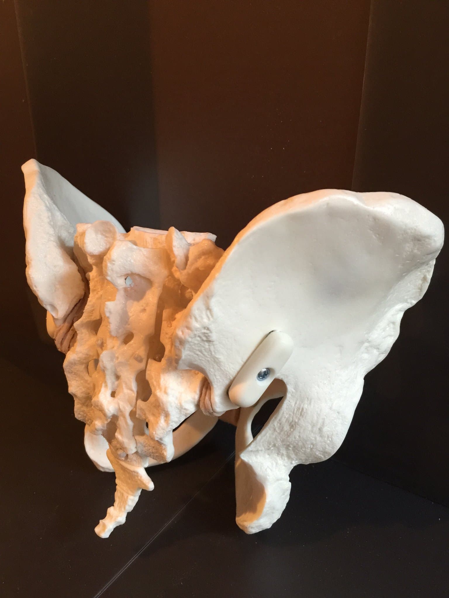 Large Flexible Pelvis