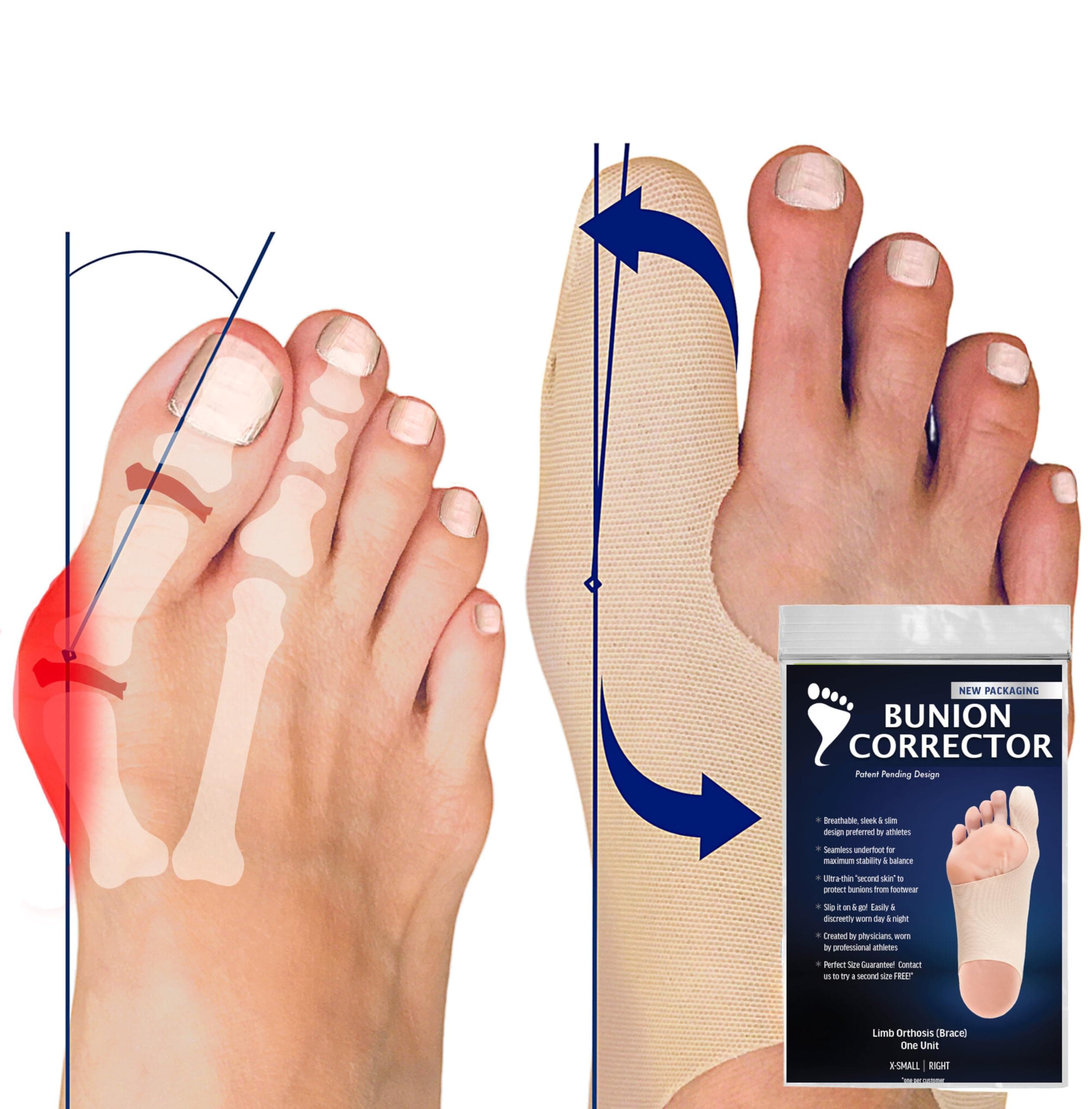 Bunion Corrector for Men & Women. Ultra-Thin Big Toe Straightener. Correction While You Walk. Flexible & Comfortable Hallux Valgus Sock That Fits Inside All Shoes. X-Large-Right