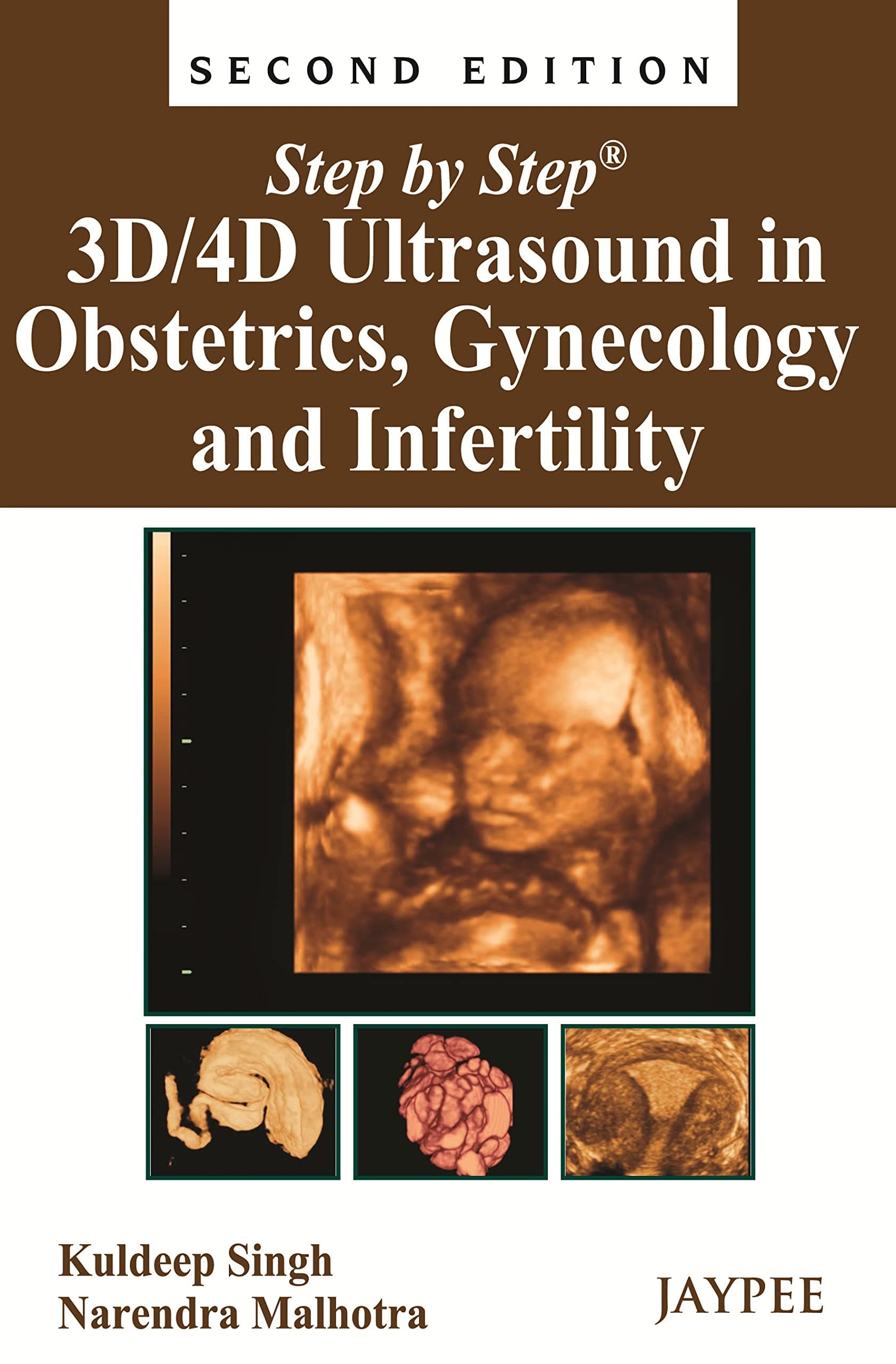 Step by Step: 3D/4D Ultrasound in Obstetrics, Gynecology and Infertility Paperback – 30 Aug. 2013