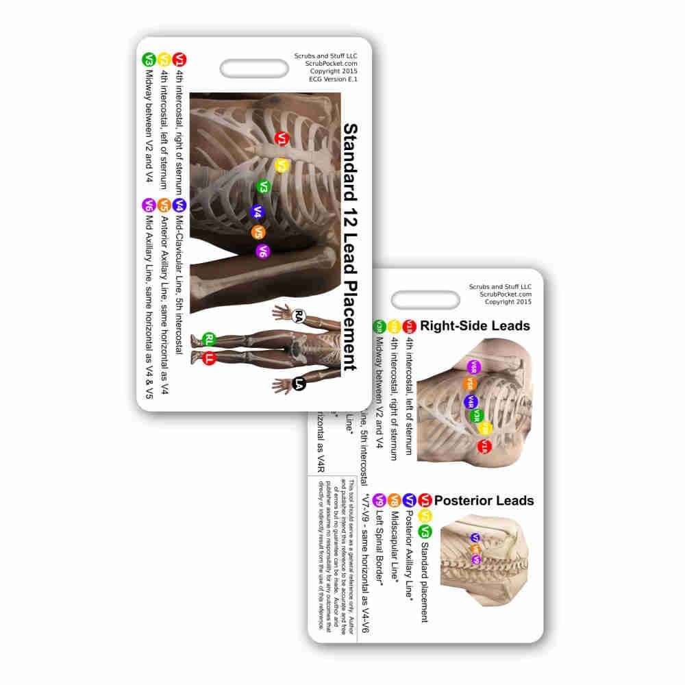 Scrubs and Stuff LLC 12 Lead EKG Placement Vertical Badge Reference Card (1 Card)