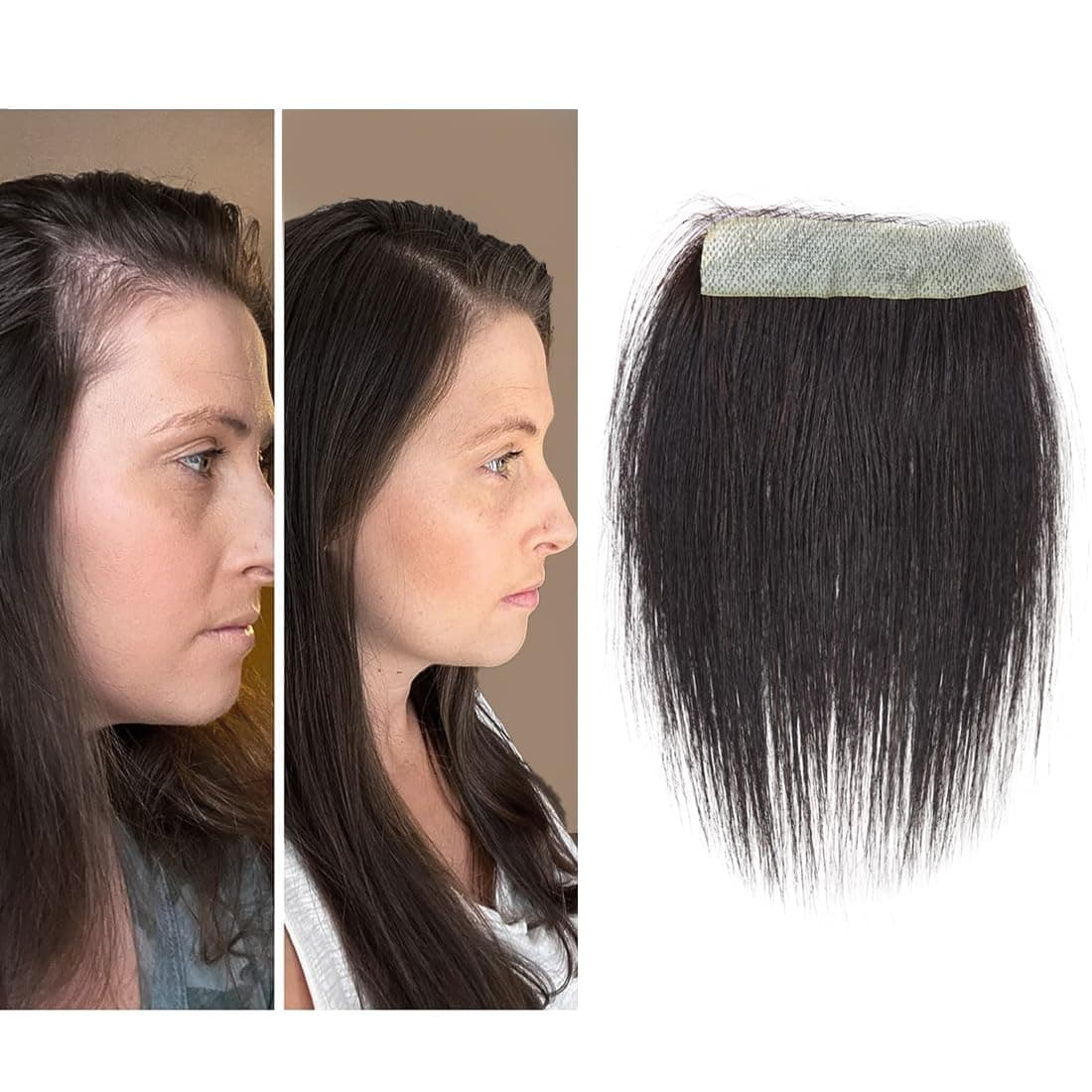 scar human hair replacement Accidental burns without hair for men women Hairline Loss Straight Tape in Replacement Toupee(Natural Black, 0.78"x3")